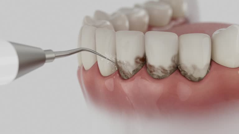 Trusted Emergency Dentist service in Caro, MI - Dentist Open Now